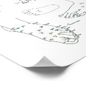 Acupunctie Behandeling van pijn en hoofdpijn Poster (Hoek)