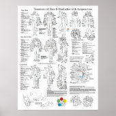 Acupunctie Behandeling van pijn en hoofdpijn Poster (Voorkant)