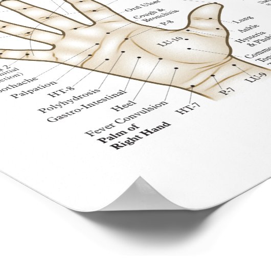 Acupunctie Microsystem points Poster (Hoek)