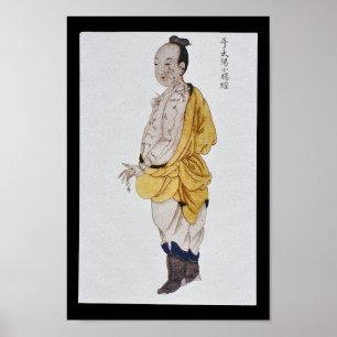 Acupunctie Small Intestine Meridian Hand Taiyang Poster