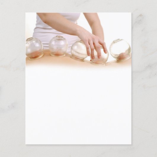 Acupunctiesbrochure Flyer (Voorkant)