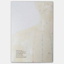 Acupunctietest vervaagt post-it® notes