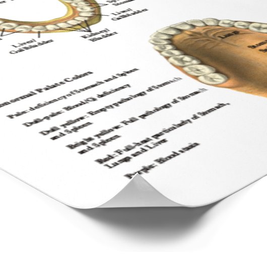 Acupuncture Dental Teeth Meridians Poster (Hoek)