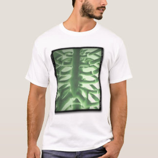 ACWE Portable Chest X-Ray T-shirt