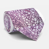 Adenoïd cystechnoomcarcinoom traanklier stropdas (Opgerold)