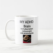 ADHD Turbocharge Brain met Fietsremmen Mok (Links)