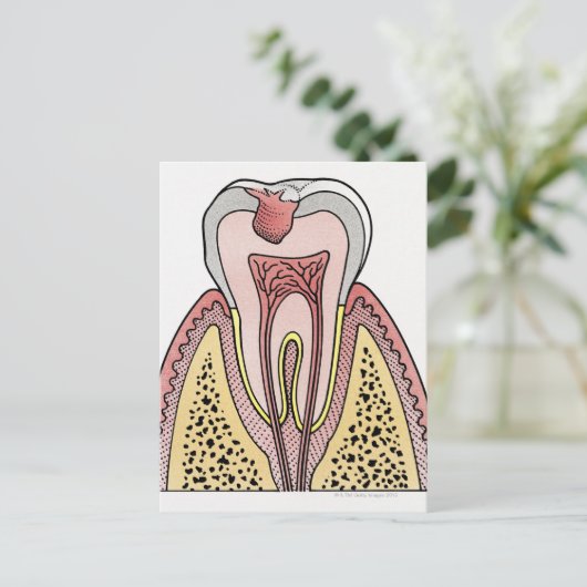 Afbeelding kruissectie met tandbederf briefkaart (Staand voorkant)