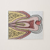 Afbeelding kruissectie met tandbederf legpuzzel (Horizontaal)