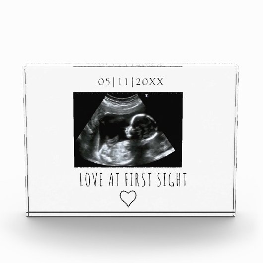  Afbeelding Sonogram Gift Baby Ultrasound fotoblok (Voorkant)