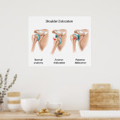 Afgelegen schouderPoster Poster (Keuken)