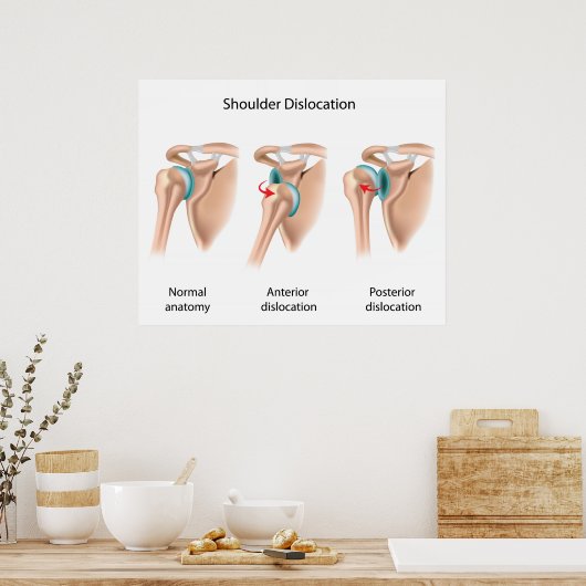 Afgelegen schouderPoster Poster (Keuken)