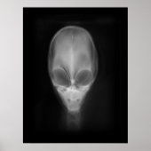 Alien Skull-röntgenfoto Poster (Voorkant)