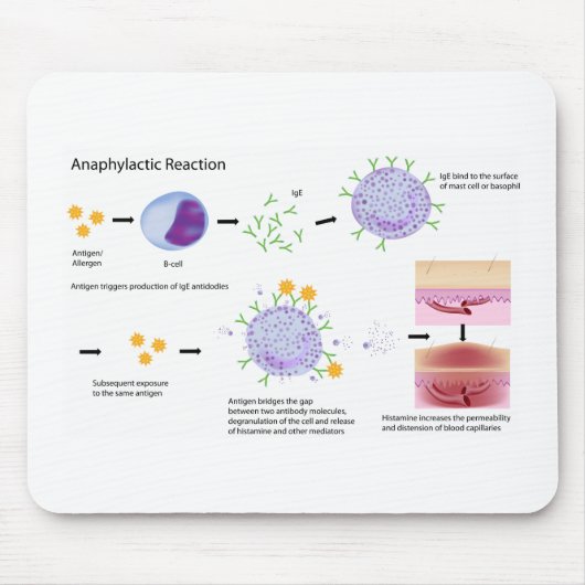 Allergy Mousepad voor de medische school Muismat (Voorkant)