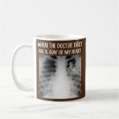 Als de dokter röntgenfoto van mijn hart neemt, is  koffiemok (Links)