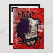 als je me pijn doet in het anatomische hart briefkaart (Voorkant / Achterkant)