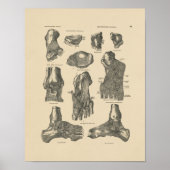  anatomie 1880 afdrukken poster (Voorkant)