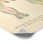  anatomie Afdrukdermatomen Nerve Patronen Poster (Hoek)