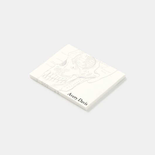  Anatomie Anterolateraal gebied van de schedel Post-it® Notes (Schuin)