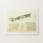  anatomie | Armossen (circa 1852) Legpuzzel (Horizontaal)