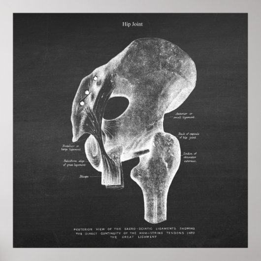 Anatomie Art nr. 4 Hip Joint Poster (Voorkant)