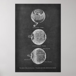 Anatomie-arteriën van de chromosoïde en de iris poster