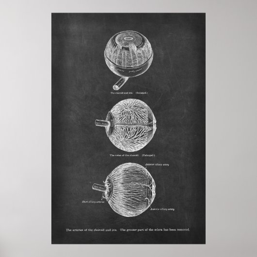 Anatomie-arteriën van de chromosoïde en de iris poster (Voorkant)