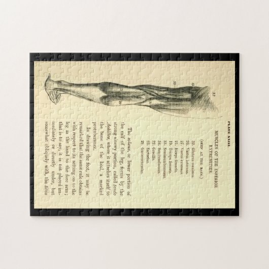  anatomie | Beenspieren Legpuzzel (Horizontaal)