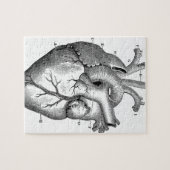 Anatomie-hart-Afbeeldingen- Legpuzzel (Horizontaal)
