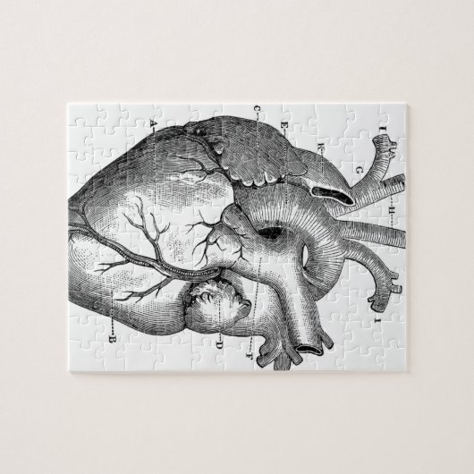 Anatomie-hart-Afbeeldingen- Legpuzzel (Horizontaal)