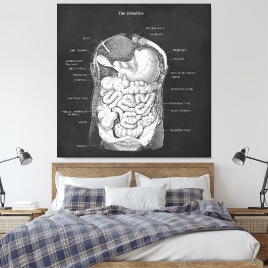 Anatomie Kunst Intestinale Gastro-enteroloog Decor Canvas Afdruk (Insitu (Slaapkamer))