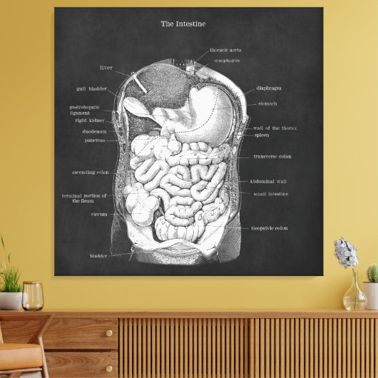 Anatomie Kunst Intestinale Gastro-enteroloog Decor Canvas Afdruk (Insitu (Woonkamer))
