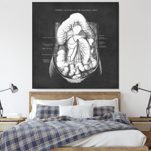 Anatomie Kunst van het spijsverteringsstelsel Doct Canvas Afdruk (Insitu (Slaapkamer))
