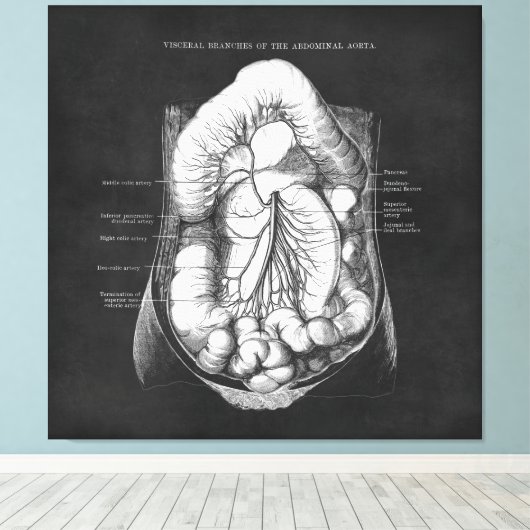 Anatomie Kunst van het spijsverteringsstelsel Doct Canvas Afdruk (Insitu (Houten vloer))