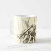  anatomie | Schoudergewricht (circa 1852) Koffiemok (Voorkant links)