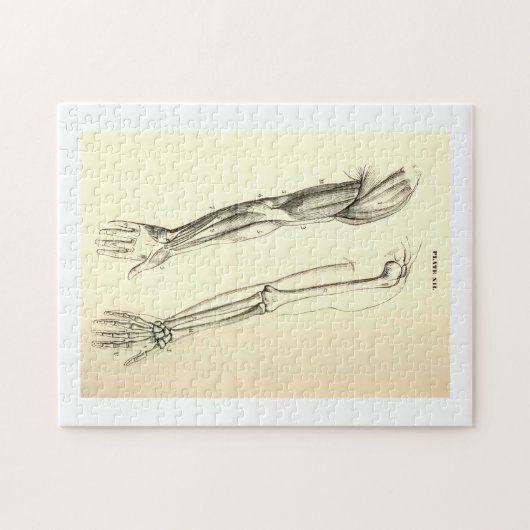  anatomie | Spier en Bot van de Arm Legpuzzel (Horizontaal)