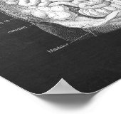 Anatomie van darmen Gastro-enteroloog Decor Poster (Hoek)