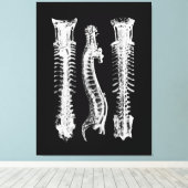 Anatomie van de menselijke wervelkolom Grote Canva Canvas Afdruk (Insitu (Houten vloer))