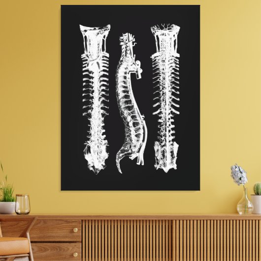 Anatomie van de menselijke wervelkolom Grote Canva Canvas Afdruk (Insitu (Woonkamer))