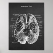 Anatomie van de onderkant van het remblok nr.1 poster (Voorkant)