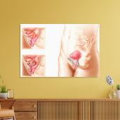 Anatomie van een blaasophanging canvas afdruk (Insitu (Woonkamer))