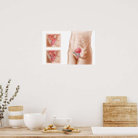 Anatomie van een blaasophanging poster (Keuken)