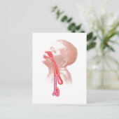 Anatomie van een tracheesophageale fistels briefkaart (Staand voorkant)