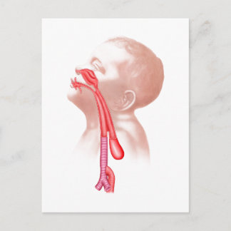 Anatomie van een tracheesophageale fistels briefkaart