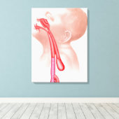 Anatomie van een tracheesophageale fistels canvas afdruk (Insitu (Houten vloer))