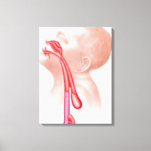 Anatomie van een tracheesophageale fistels canvas afdruk