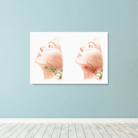 Anatomie van gezwollen lymfeknoden canvas afdruk (Insitu (Houten vloer))