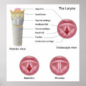 Anatomie van het larynxPoster Poster (Voorkant)