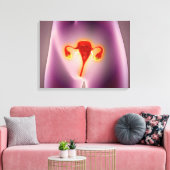 Anatomie van het Vrouw met baarmoeder Canvas Afdruk (Insitu (Woonkamer))