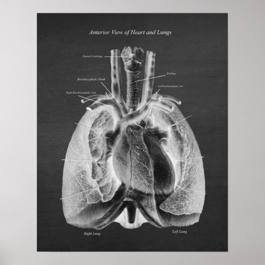 Anatomie van Lungs Hart Anterior Uitzicht Poster (Voorkant)