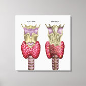 Anatomie van schildklier met Larynx en kraakbeen Canvas Afdruk (Voorkant)
